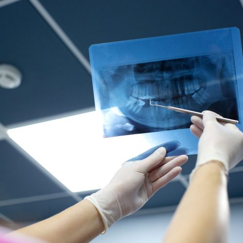 dentist checks x ray photo of mouth